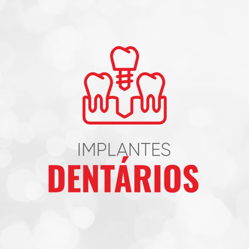 Implantes dentários