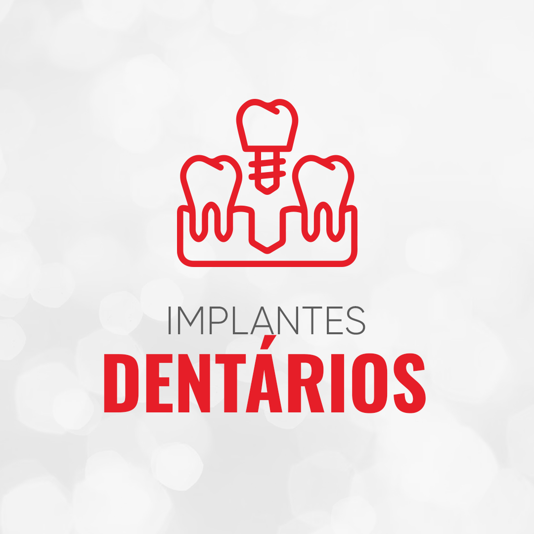 Implantes Dentários