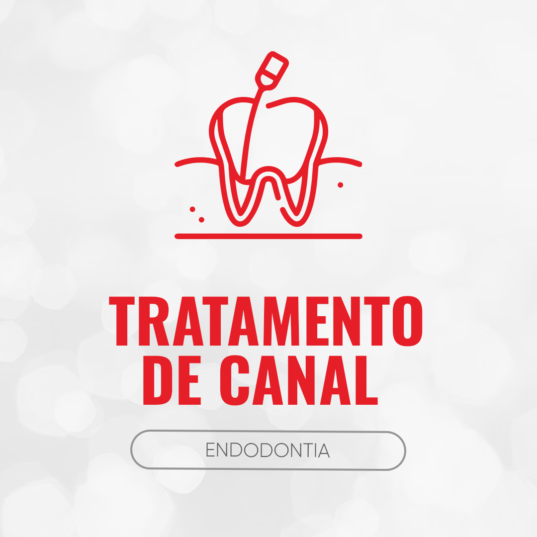 Tratamento De Canal (Endodontia)